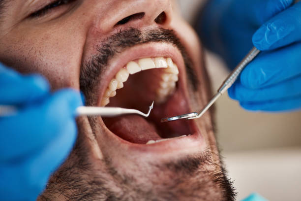 Best Emergency Treatment for Dental Infections or Abscesses in Weedpatch, CA