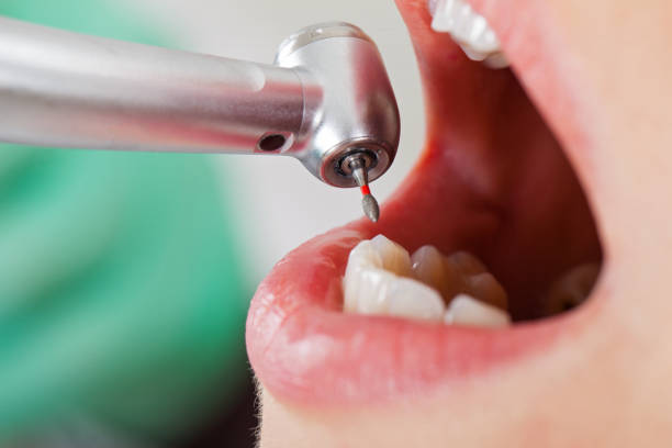 Best Emergency Treatment for Dental Infections or Abscesses in Weedpatch, CA